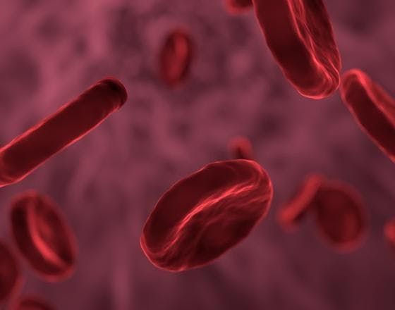CTX001 Data Suggest Possible Functional Cure for Sickle Cell, β-Thalassemia