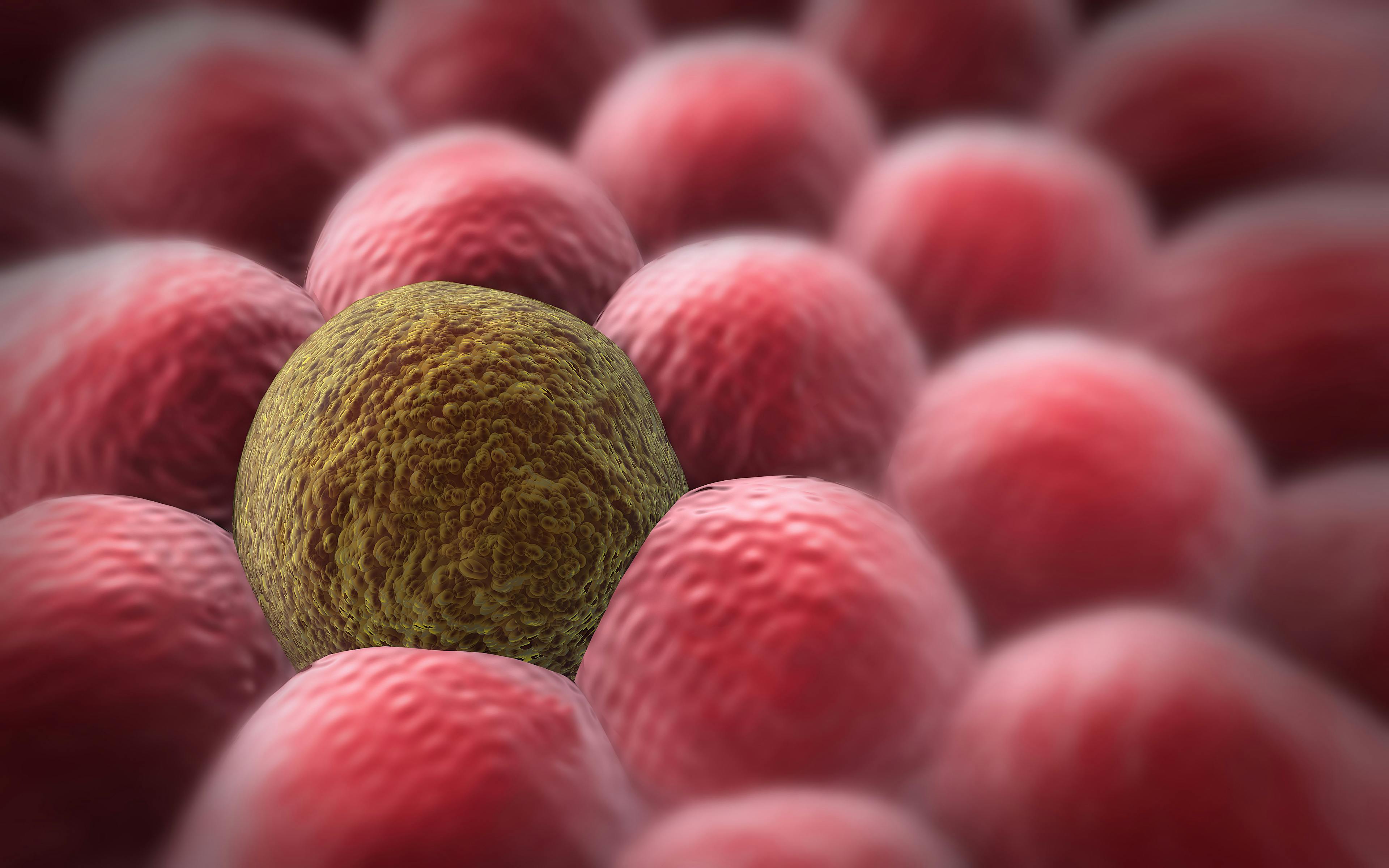 T-Cell Therapy Gets Orphan Drug Designation for Pancreatic Cancer