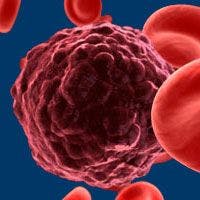 FDA Grants Moxetumomab Pasudotox Priority Review for Hairy Cell Leukemia